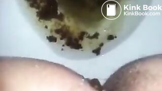 runny shit between legs 3