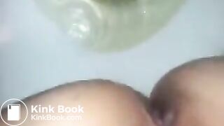 runny shit between legs 3