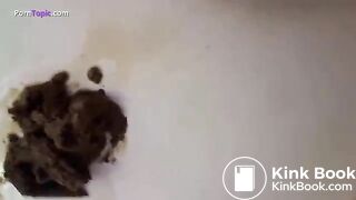 Poo Spa Prolapse