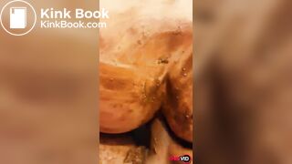 nice view of shitty ass