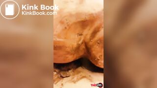 nice view of shitty ass