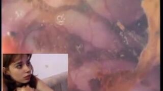 3 girls rectal cam, anal, and shitty cumfart in glass