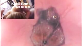 3 girls rectal cam, anal, and shitty cumfart in glass