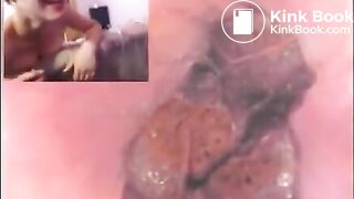 3 girls rectal cam, anal, and shitty cumfart in glass