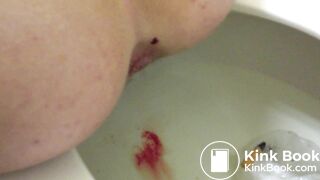 21 Year Old Mary Shitting 2