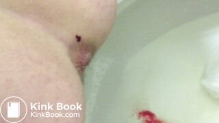 21 Year Old Mary Shitting 2