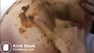 Doctors swallowing a patient's poop