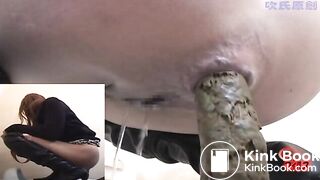 It's amazing to see a little girl hold in that much poop, for at least 2 or 3 days