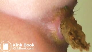 Girl's has a yellow diarrhea