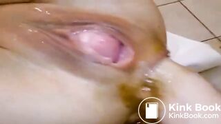 Anal fist with scat and prolapse