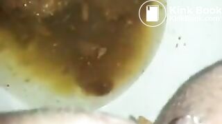 runny shit between legs 2