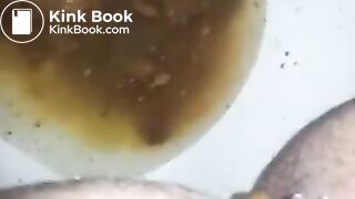 runny shit between legs 2