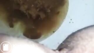 runny shit between legs 2