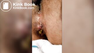 Soft poop -- sitting