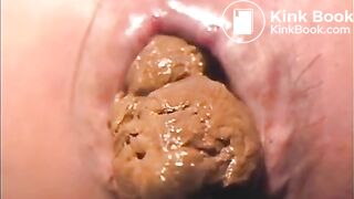 Volcano full of hot turds