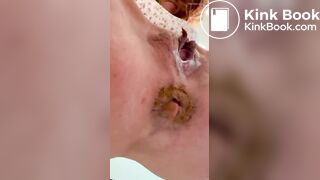 redhead poops in a trashcan