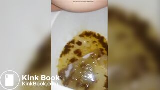 Closeup Diarrhea