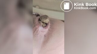 hard shit great close up view