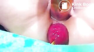 prolapse 2 poo