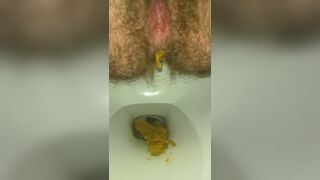 Massive Dump From Hairy Trans Ass