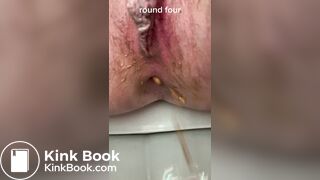 diarrhea 7 times