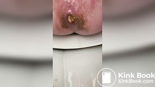 diarrhea 7 times