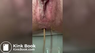 diarrhea 7 times