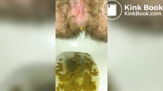 Firm Start, Liquid End
