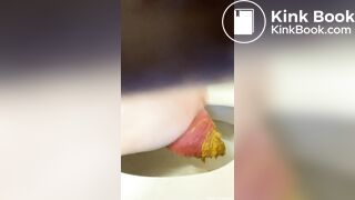 Prolapse toilet - video 2