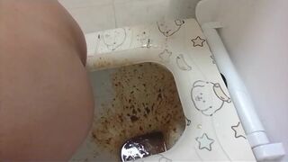 Severe diarrhea - video 6