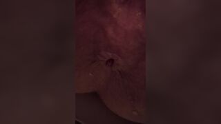 Asshole empty poo