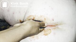 Bbw shitty anal play and foot job