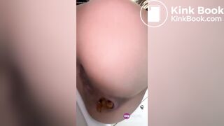 He strains and poops