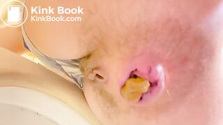 Broken butthole girl