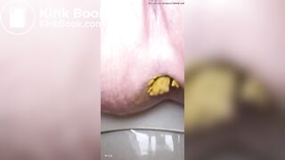 Soft diarrhea close up girl
