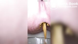 Soft diarrhea close up girl