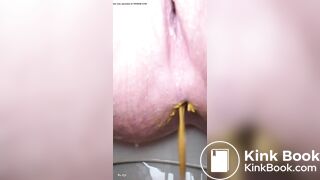 Soft diarrhea close up girl