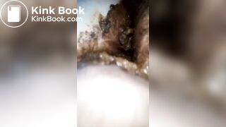 Fingering my SSBBW shitty asshole pt 3