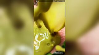 girl diarrhea fountain