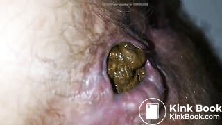 Shit in more detail