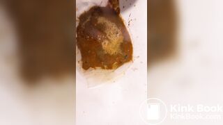 Chinese girl have watery diarrhea1