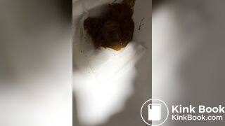 Chinese girl have watery diarrhea1
