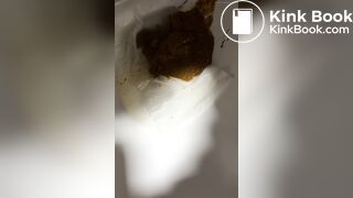 Chinese girl have watery diarrhea1