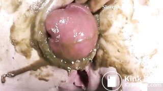 Grapes of ass