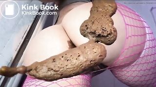 Poop on anal bead