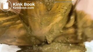 Girl diarrhea and smearing