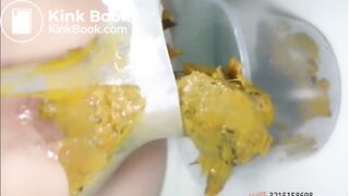 Chinese Girl Anal Gape Pooping 2