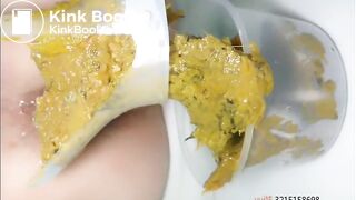 Chinese Girl Anal Gape Pooping 2