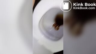 toilet dirrarea