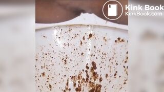 A Simple Ice Cream Ruined His Gut for Days